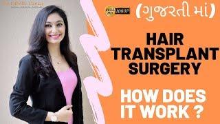 (In Gujarati) Hair Transplant Surgery in Ahmedabad, Gujarat [How Does It Work?]