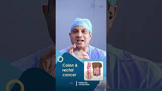 How Is Colon Cancer Treated? | Insights from Dr Nilesh chordiya, SSO