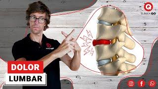 Dolor Lumbar causado por Hernias Discales y Protusiones. Ejercicios para Aliviar la Lumbalgia.