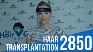 Haartransplantation bei einer Frau - Erfahrung Türkei