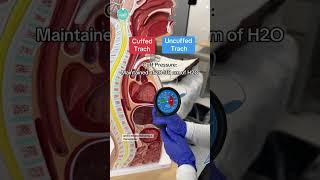 🫁 Tracheostomy Tubes: Cuffed Vs. Uncuffed #RN #BSN #futurenurse
