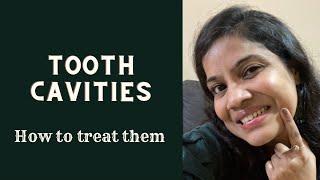 How to treat tooth cavities in kids 