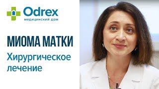 Миома матки - хирургическое лечение