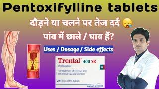 Trental 400 mg tablet | Trental 400 mg | Pentoxifylline tablets | Pentoxifylline uses