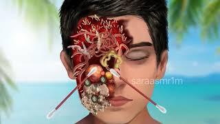 ASMR Maggot Infested Chest & Remove Infested Wounds, Dog Ticks _ Deep Cleani_Full-HD