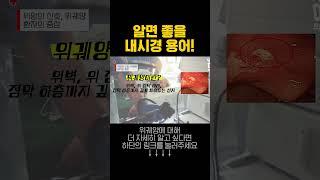 내시경 받기전 알아두면 좋은 용어들