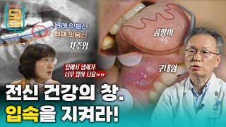 [Full] 겉으로 드러나지 않는 구강 질환, 당신의 구강은 안녕하십니까?ㅣ귀하신 몸ㅣ75화 전신 건강의 창, 입속을 지켜라