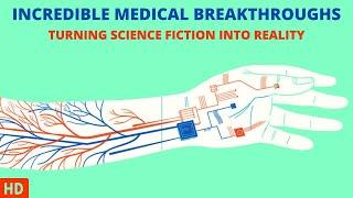 Medical Marvels: Astonishing Breakthroughs You Won't Believe