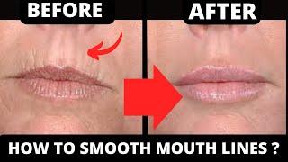 Get Rid of Mouth Lines: Face Yoga & Massage for Smooth Skin