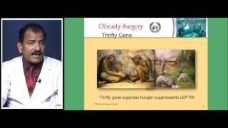 Obesity Surgery Sleeve Gastrectomy Lecture by Dr R K Mishra