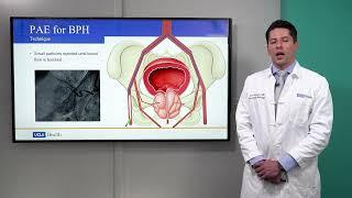 Prostatic Artery Embolization Procedure Technique | Lucas R. Cusumano, MD, MPH