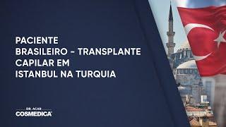 Paciente Brasileiro - Transplante Capilar em Istambul na Turquia