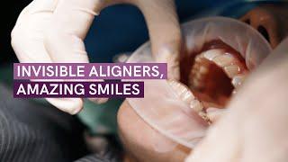 Invisible aligners, amazing smiles