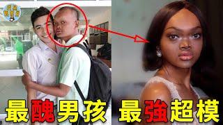 男孩因太醜被嘲笑，整容變性後逆襲成超模，火遍全球揚眉吐氣｜整容｜變性｜明星觀察員