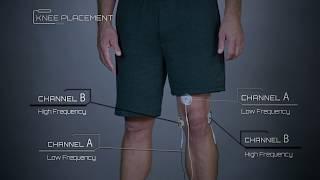 Knee Placement Example