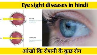 आंखो कि रोशनी के कुछ रोग //Eye sight problem in hindi #medifactak