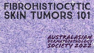 Fibrohistiocytic Skin Tumors 101 (Australasian Dermatopathology Society 2022 meeting) pathology