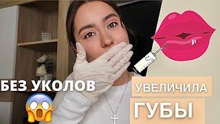 УВЕЛИЧИЛА САМА СЕБЕ  ГУБЫ ГИАЛУРОН ПЕН | БЕЗЫГОЛЬНОЕ УВЕЛИЧЕНИЕ ГУБ