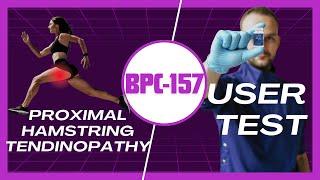 Testing BPC 157 for Proximal Hamstring Tendinopathy - Apeiron Elements