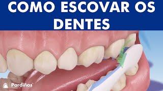 Como escovar os dentes corretamente ©