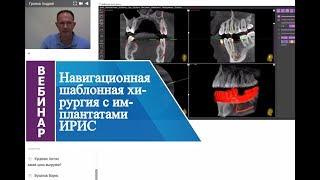 Вебинар_Навигационная шаблонная хирургия с имплантатами ИРИС