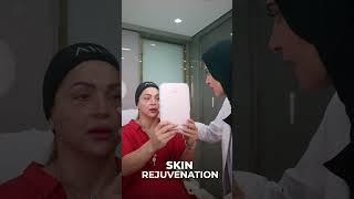 Face & Neck Rejuvenation  #beauty