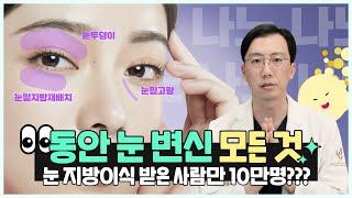 ⭐눈 지방이식은 【        】하게 해야돼요?! #성공적 #노하우 · 쌍수 안하고‍️‍️지방이식만 가능? #최문섭원장님 그레이스오앤영 (ep.2)