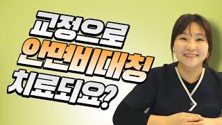 안면비대칭을 치아교정만으로 치료할 수 있을까요?  I 수원 김기록치과