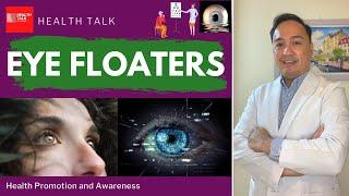 Eye Floaters: Signs, Symptoms, Causes, Risk factors, Diagnosis, Treatment & Prevention