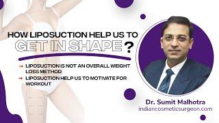 How Liposuction Help Us TO Get In Shape | Dr. Sumit Malhotra