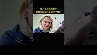 男人补牙遇到意外，竟被牙医用石膏粘住了嘴巴