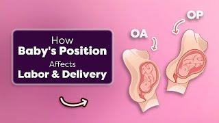 Is Baby’s Position Slowing Your Labor? How to Fix It Fast