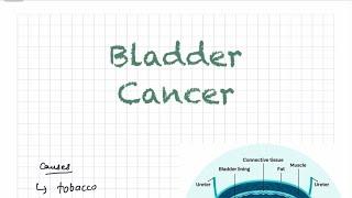 Bladder Cancer l UROLOGY l Surgery l Urologic Tumors