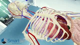 TAVR Operation