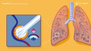 How COVID-19 Makes Breathing Difficult