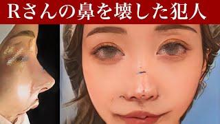 人気YouTuber、Rさんの鼻をピサの斜塔にした美容外科医まじ許せねぇ〜猫手術、貴族手術