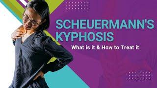 Scheuermann's Kyphosis - What is it & How to Treat it