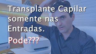 Transplante Capilar Somente nas Entradas. Pode???