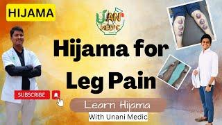 Hijama(Cupping)-Hijama For Leg Pain | Best Cure for leg pain, swelling | Unani therapy | Unani Medic