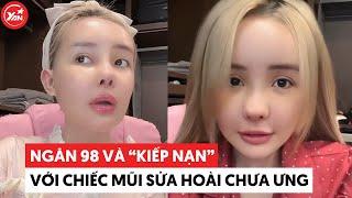 Ngân 98 và "kiếp nạn" với chiếc mũi sửa hoài chưa ưng