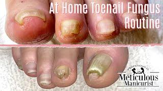 DIY Pedicure At Home - Simple Tips & Tricks for Daily Toenail Care