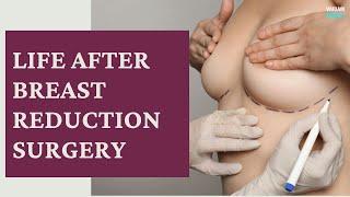 Life After Breast Reduction