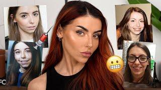 EVERYTHING I’ve had done to my face | The TRUTH - Botox, Fillers, Surgery..