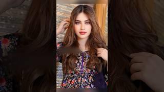 Pakistani Drama Actresses Who Did Face Surgery Part 2