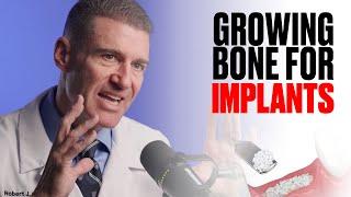 Can You REALLY Grow Bone for Dental Implants?