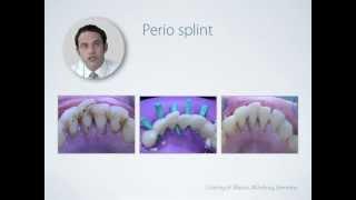 DENTAPREG constructive composites