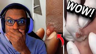 DO YOU SEE THE SIZE OF THAT CYST?!