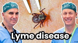 Lyme Disease and Ticks - Causes, Treatments and More