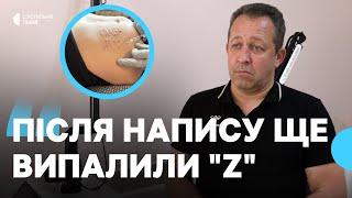 "Це зробив хірург" — медик про напис "Слава России" на тілі звільненого з полону воїна