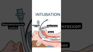 #ларингоскоп #medical